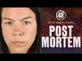 Death by Eye Drops Full Episode Post Mortem