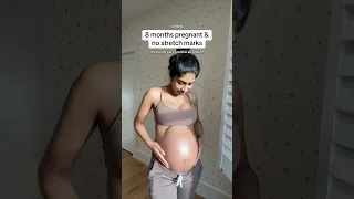 My pregnancy bump routine to help prevent stretch marks as a derm