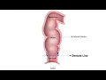 HCC 1475 7b Rectum Anus Anatomy