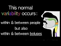 Bolus depth variability in a healthy adult swallowing ice pudding thin thin honey honey nectar