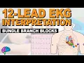Bundle Branch Blocks MADE EASY - 12 Lead EKG