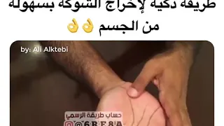 طريقة اخراج الشوك من الجسم بسهولة 