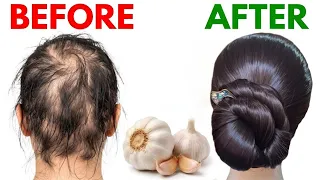 Garlic And Black Pepper For 30x Rapid Thick Black Hair Growth💥 Faster Silky SmoothHair🤩