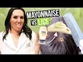 Removing LICE with MAYONNAISE Watch this before you try