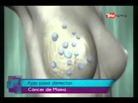 App para detectar cáncer de mama