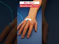 Download Lagu How does chemotherapy work?