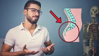 علاج مشكلة بروز المؤخرة عند الرجال 