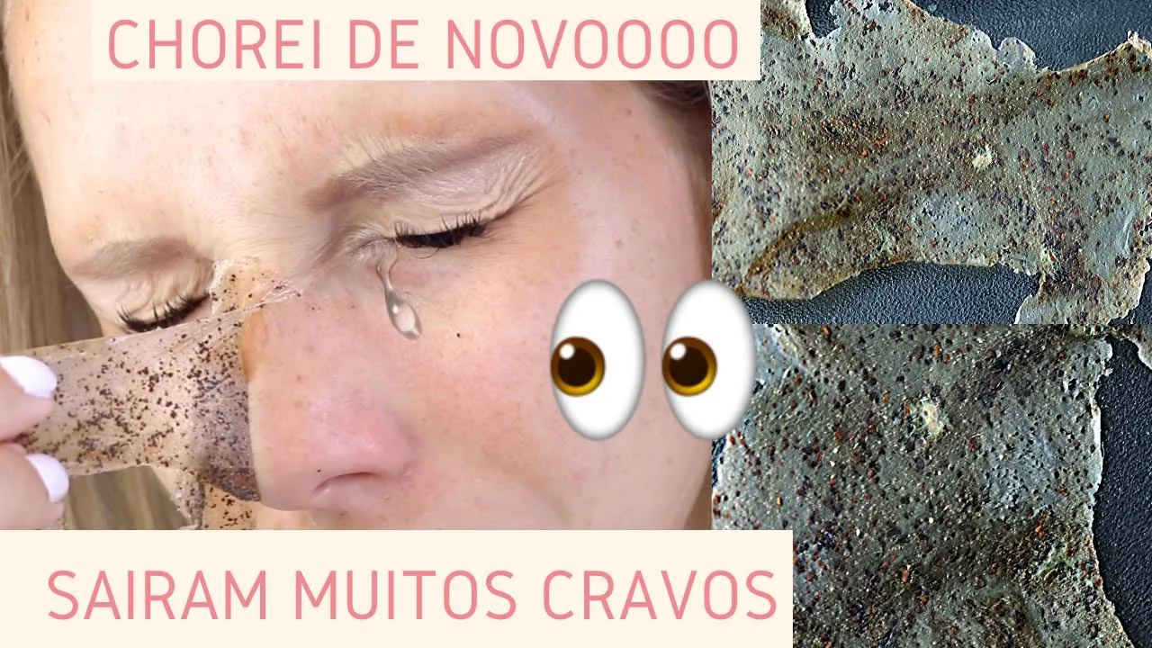 Acabe com as MANCHAS NA PELE, inclusive MELASMA - Receita Caseira
