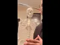 Contusions of the Sternum What Are They