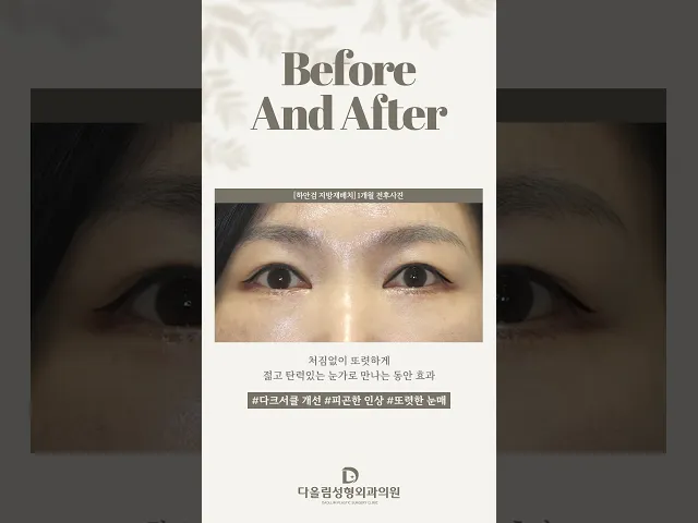 YouTube 영상