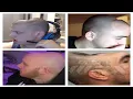 Gamer Dent