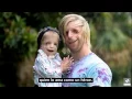 Jono Lancaster sindrome treacher collins