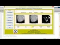 Matlab Code for Breast Cancer Detection and Classification in Mammogram Using Neural Network