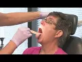How to spot early symptoms of oral cancer