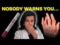 Humira Side Effects Cost 10 Things to Know Before You Start