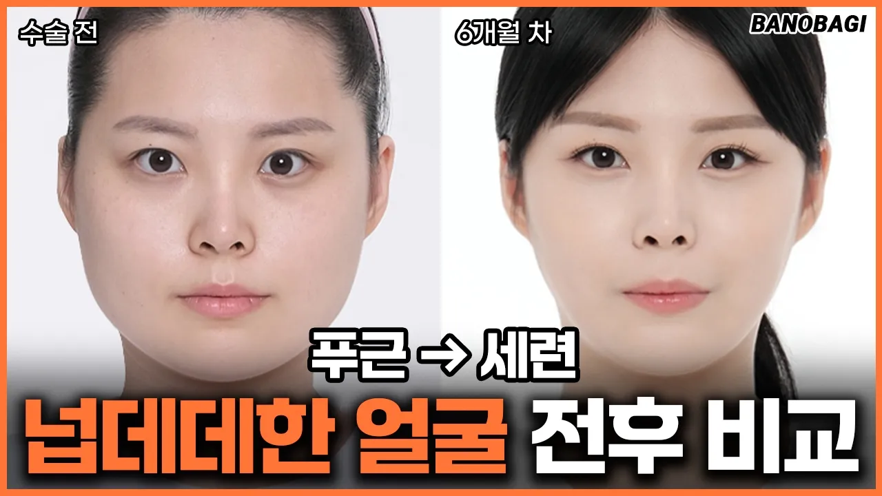 푸근하고 넙데데한 얼굴에서 세련된 얼굴로 변신😘