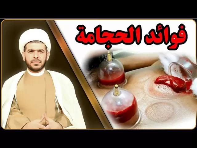 اسـرار غــريــبــة وعــجــيــبـة فــي الــحـجـامــة