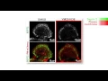biosights August 29 2016 - Septins step in to promote macropinosome fusion