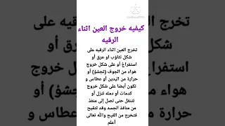 كيفيه خروج العين اثناء الرقيه Shorts 