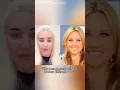 Why does Amanda Bynes looks so different now