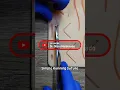 Simple Running Suture Part 1