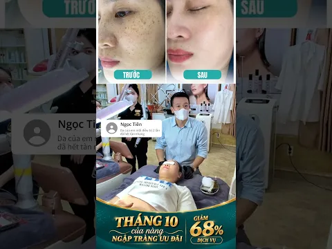 SỰ THẬT TRỊ TÀN NHANG SAU 2 LẦN LÀ HẾT ?| Đào Ngọc Anh { Thẩm Mỹ }
