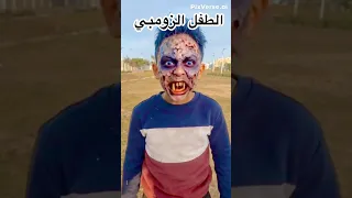 لما طفل يتحول زومبي وتجري 