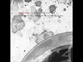 Do They Owe Us a Living? (Crass in Demo)