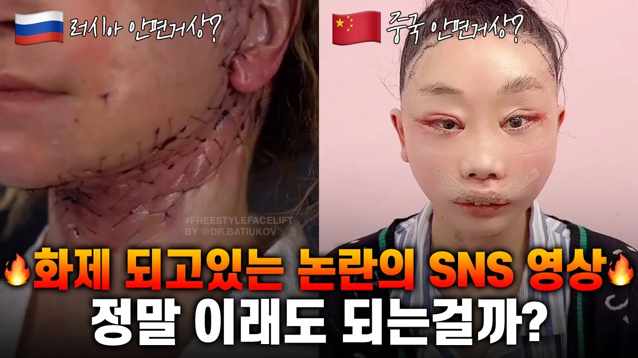 SNS 논란의 안면거상😱 진짜 왜 이래..?