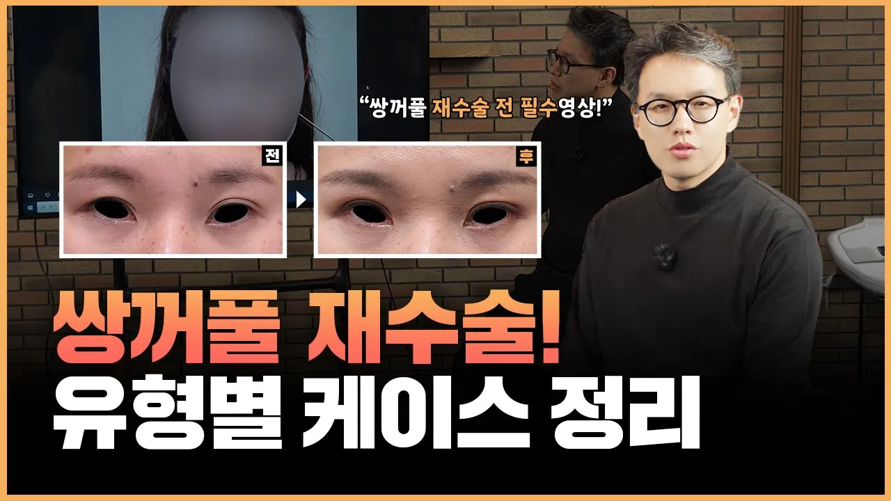 쌍꺼풀 부작용별 재수술 하는 방법ㅣ실제 환자 케이스 리뷰!