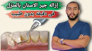 إزالة جير الاسنان فى المنزل بدون طبيب 7 طرق طبيعية لإزالة جير الاسنان 