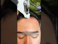Download Lagu Nggak percaya diri karena botak? Yuk coba Treatment PRP Hair Regworth di MEN/O/LOGY !