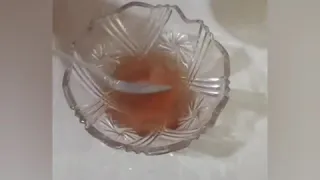 اسهل طريقة للتخلص من القمل خاصة لدى الأطفال خلال ساعة 