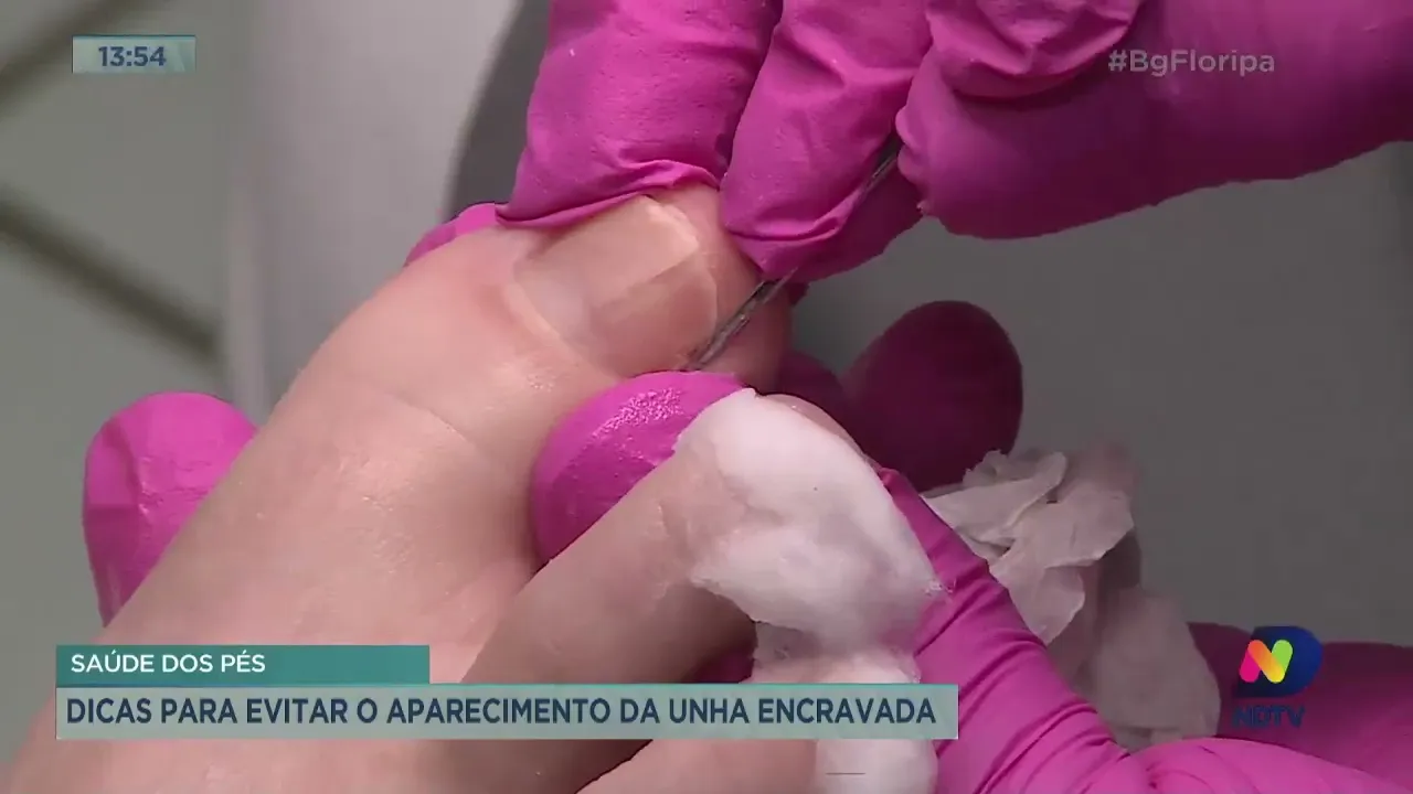 Saiba como evitar unha encravada