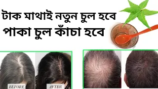 টাক মাথায় চুল গজানোর উপায় এবং অকালে পেকে যাওয়া চুল কাঁচা হবে,Benefits of Neem Oil for Hair