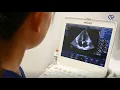 Transthoracic Echocardiography - What does it check for