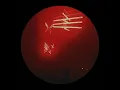 Strange Objects
