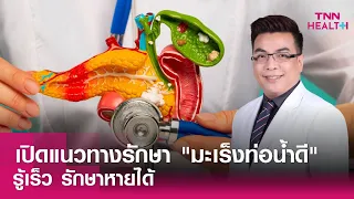 อาการของมะเร็งท่อน้ำดีมีอะไรบ้าง และตรวจวินิจฉัยอย่างไร