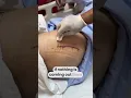 Download Lagu How to do surgical dressing at home, like a DOCTOR ? #wounddressing  #totalhipreplacementsurgery