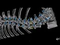 Navient AI-Powered Spine Planning