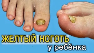 Ребенок СТЕСНЯЛСЯ своих ног