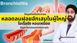 การวินิจฉัยโรคหลอดลมฝอยอักเสบใช้เทคนิคอะไรบ้าง