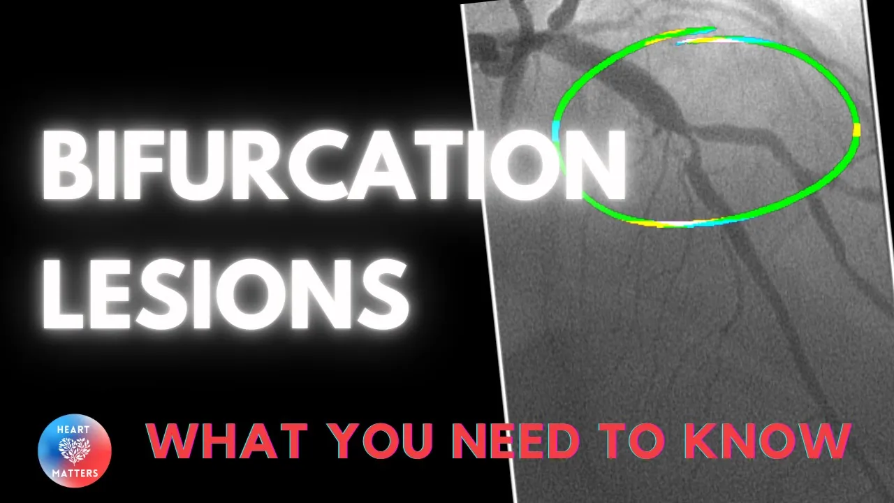 Bifurcation Coronary Lesions