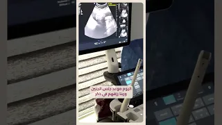 حالة تأخر إنجاب لزوجين عزيزين ومميزين 