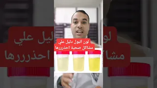 لون البول دليل علي مشاكل صحية كتير احذرها 