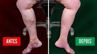 Faça 5 Exercícios Simples Sentado no Trabalho para Melhorar a Circulação das Pernas