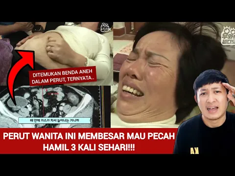 WANITA INI HAMIL 3X DALAM SEHARI !! TERUNGKAP ISI DIDALAM PERUTNYA SANGAT MENGERIKAN, TERNYATA..!!