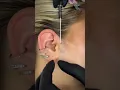 Lagu Surface Tragus Piercing ✦ Unique \u0026 Bold Ear Piercing Experience!