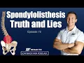 Spondylolisthesis Truth and Lies Low Back Pain Podcast