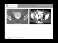 Grand Rounds - lower urinary tract trauma